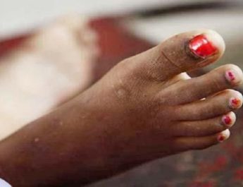 स्टोव फटने से दून में एक महिला की मौत 3 Hello Uttarakhand News »