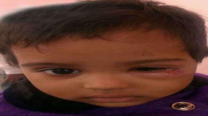 नशे में धुत पति ने पत्नी को पीटा, मासूम बेटी की आँख में दागी जलती बीड़ी 1 नशे में धुत पति ने पत्नी को पीटा, मासूम बेटी की आँख में दागी जलती बीड़ी 1 Hello Uttarakhand News »