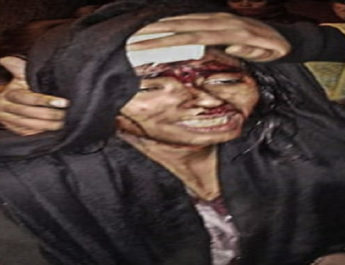 जेएनयू हमला: NUSU की अध्यक्ष बोली पूरी प्लानिंग से किया हमला, ABVP बोली उनका कोई छात्र नही है शामिल 2 Hello Uttarakhand News »