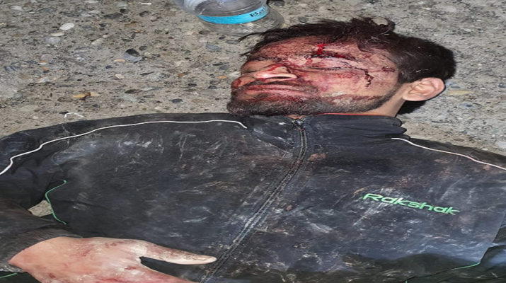 देहरादून: अनियंत्रित होकर गहरी खाई में गिरी बाइक, दोनों युवक की हालत गंभीर 1 Hello Uttarakhand News »