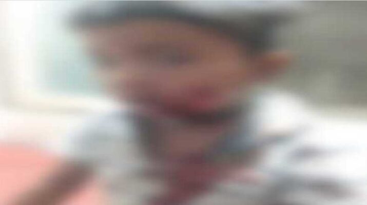 पिथौरागढ़ में गुलदार के हमले से बाल बाल बचीं मासूम की जान 1 Hello Uttarakhand News »